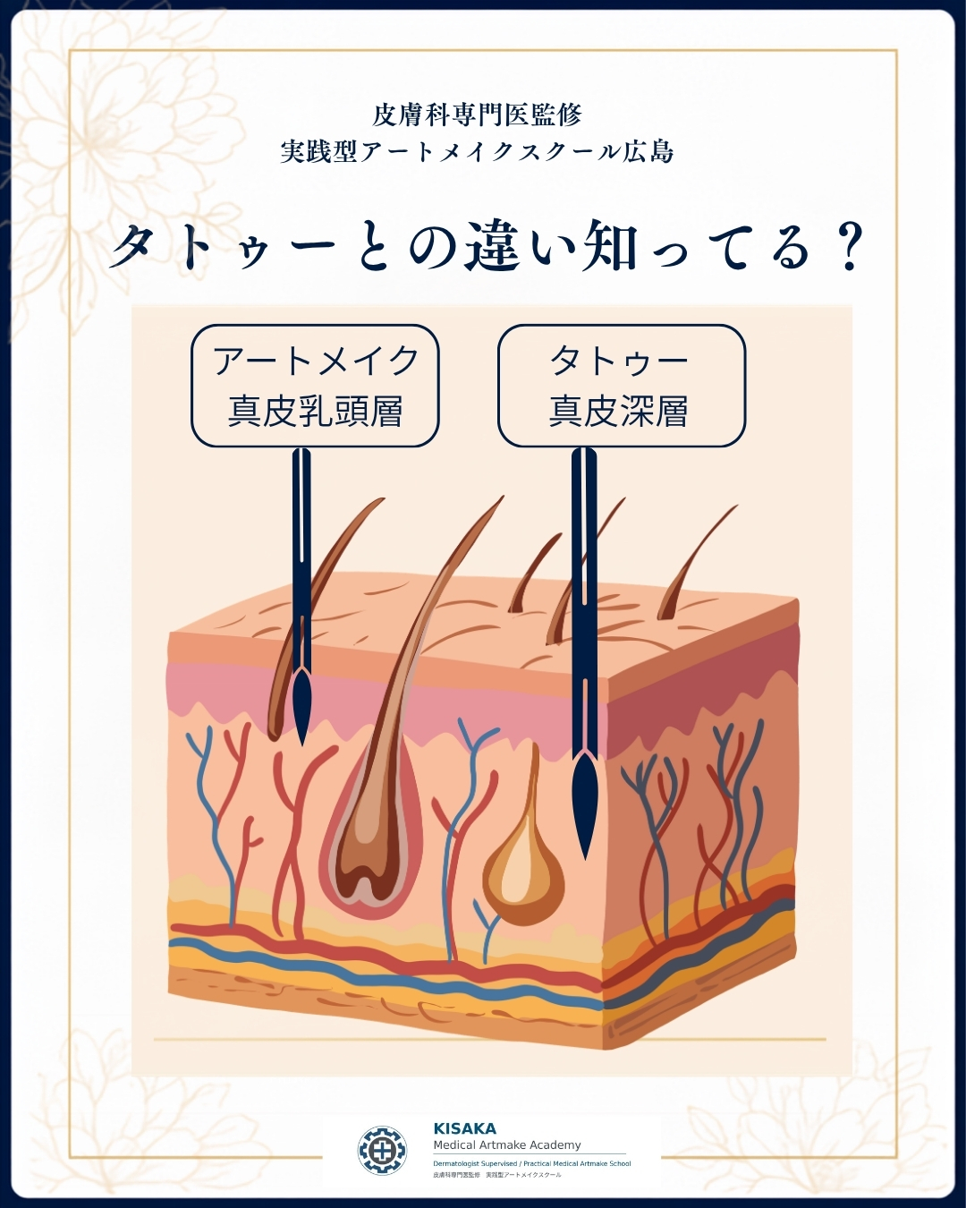 『アートメイクとタトゥーの違い』　ご存知ですか？